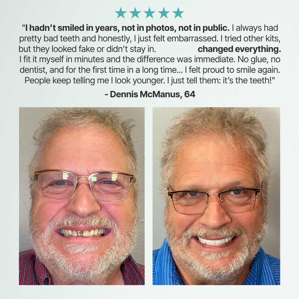 👵Health America Subsidized Product |   Custom-Fit Full Functional DenturesMake you more confident – Made in the USA & FDA-Certified